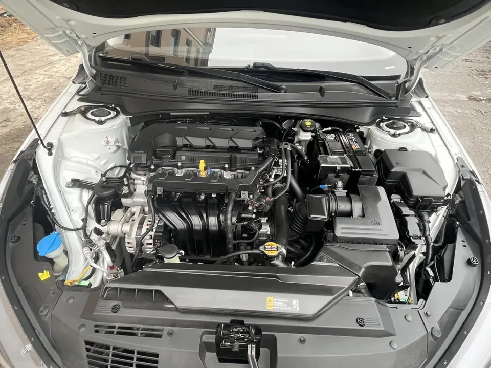 Hyundai Elantra 1.5L CVT GLX Elite Edition 2023 — миниатюра 3